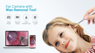 Anykit Ear Wax Removal Tool, HD Otoscope for Android and iPhone/iPad, Ultra Clear View Camera screenshot 5