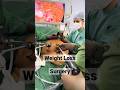 How we do weight loss treatment  bariatric surgery  fat removal