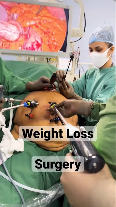 How we do WEIGHT LOSS TREATMENT ? Bariatric Surgery ? Fat removal