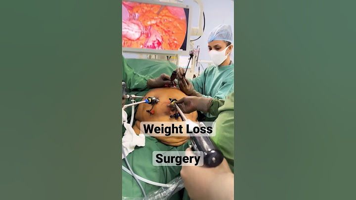 How we do WEIGHT LOSS TREATMENT ? Bariatric Surgery ? Fat removal