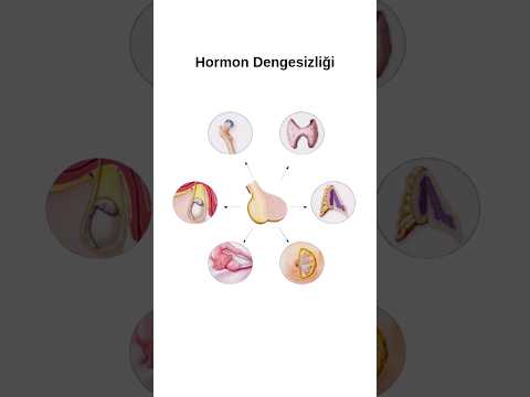 Hormon Bozukluğu Hangi