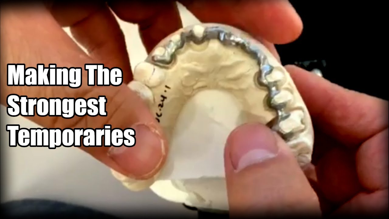 How to Make the Strongest Temporary Restoration