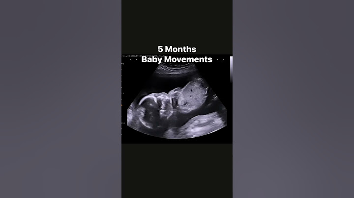 5 month baby movements #jerbearimaging #ultrasound #stephenville #wecometoyou