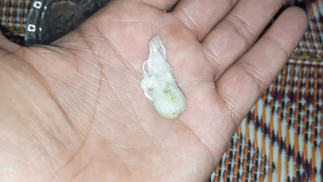 طريقة تجنب كسر بيض الحسون في العش