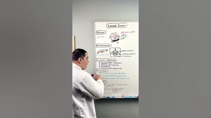 Ischemic Stroke | Lacunar Infarct #shorts - DayDayNews