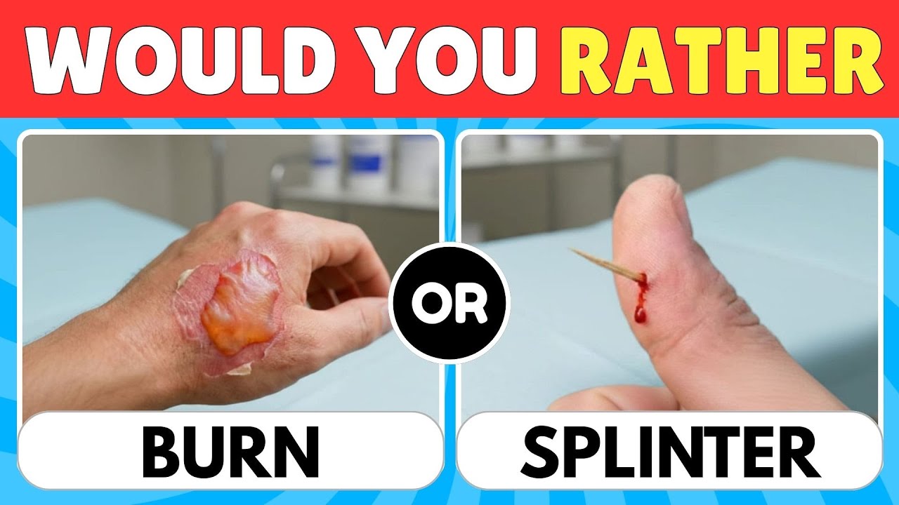 🔥 Would You Rather...? 😨 The Most Extreme Choices You'll EVER Face!🙄 Dino Quiz