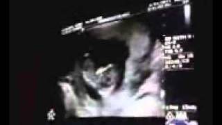 New Baby Mei And Dre