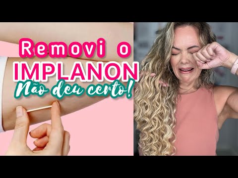 MAQUIA E FALA - TCHAU IMPLANON!