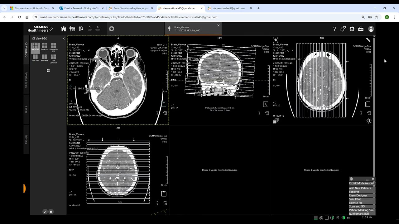 MPR e funcionalidades básicas do Smart Simulator Siemens.