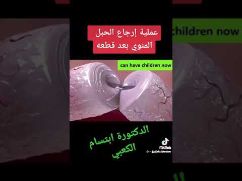 عملية إرجاع الحبل المنوي بعد قطعه