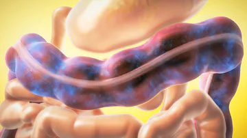 How long does it take to clean out your colon?