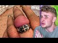 TINY Ring Gets STUCK On Girls FINGER..