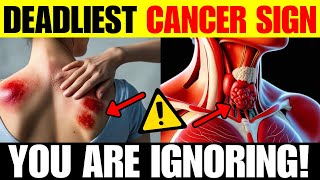 Warning: Ignoring These 10 Cancer Signs Could Cost You Your Life!