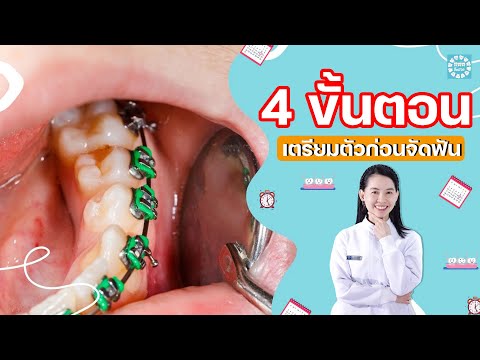 วีดีโอ: 4 วิธีในการทำให้ฟันของคุณตรง