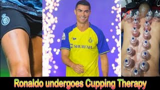 Cristiano Ronaldo undergoes Cupping Therapy Al Nasr football Club