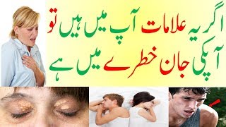 High Cholesterol Ki Alamat | Signs Your Arteries Full Of Cholesterol  | Signs Of High Cholesterol