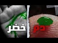 تحول لون الدم إلى اللون الأخضر 