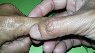 CARA MEMPERBESAR ALAT VITAL DENGAN DAUN KEMANGI