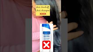 Do not waste money on Anti Dandruff Shampoos || Aloe Vera Dandruff treatment shorts