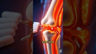 Etoricoxib In 60 Seconds Cox-2 Nsaid Explained Simply