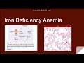 Iron Deficiency Anemia: Normal Iron metabolism and Laboratory features