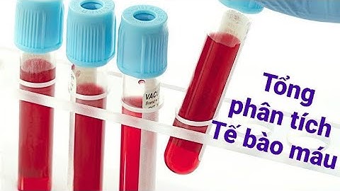 Chỉ số pct trong xét nghiệm máu là gì