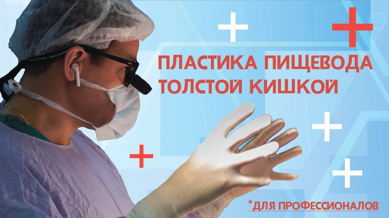 Пластика пищевода толстой кишкой