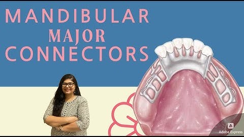Mandibular Major Connectors | Dr. Rashmi Singh