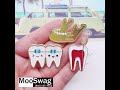 Customized Dental Pins