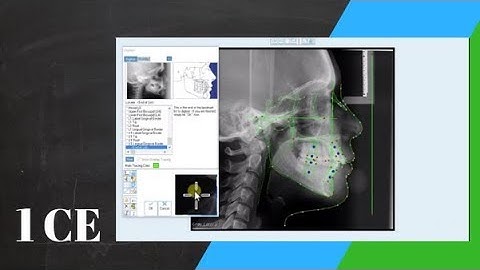 Orthodontic Ceph tracing with the Dolphin Software | Orthodontic Matters 26