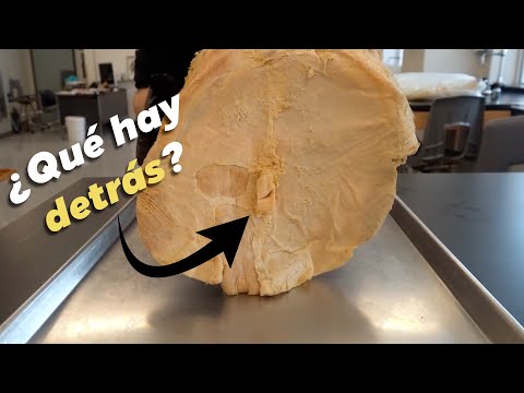 ¿Que hay detrás
