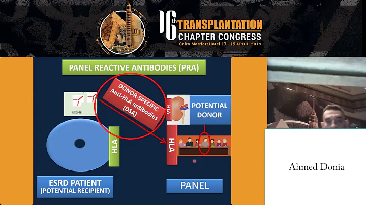 New Therapeutic strategies for the highly sensitized renal transplant candidates prof  Ahmed Donia