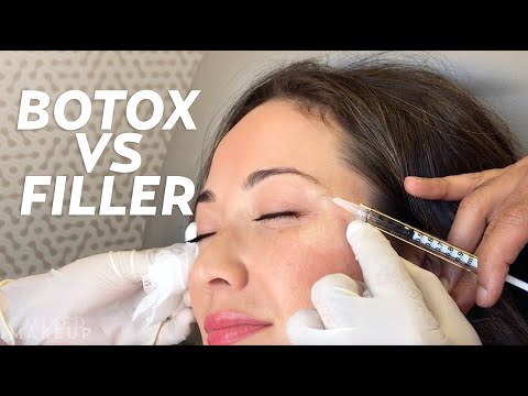 Vídeo: Botox Vs. Fillers: Qual é A Diferença?