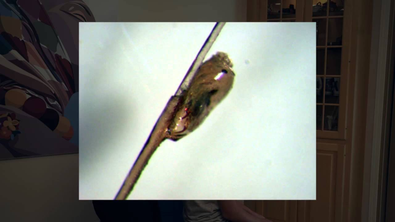 How To Check For Head Lice Nits Lice Eggs Video Tutorial YouTube How To Check For Head Lice Nits Lice Eggs Video Tutorial YouTube
