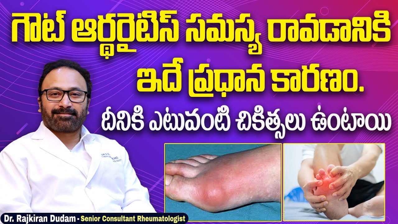 Gouty Arthritis Latest Treatment What is the Cause of Uric Acid Increase HRC Hospital