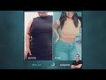 Gastric Sleeve - Before and After - Real Results  |  Miami Sleeve Center