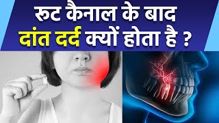 Root Canal Ke Bad Dant Me Dard Kyu Hota Hai | रूट कैनाल के बाद दांत दर्द क्यों होता है | Boldsky