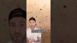 Are These Red Spots on Your Skin Dangerous?