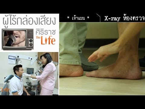 ศิริราช The Life [by Mahidol] ตอน ผู้ไร้กล่องเสียง , เท้าแบน