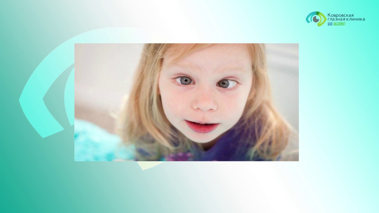 Лечится ли косоглазие у детей? - YouTube