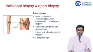 Biopsy What You Need To Know By Dr. Vivek Verma @ConceptualOrthopedics screenshot 5