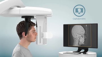 Introducing the CS 8100 3D Family With Cephalometric Imaging Option1