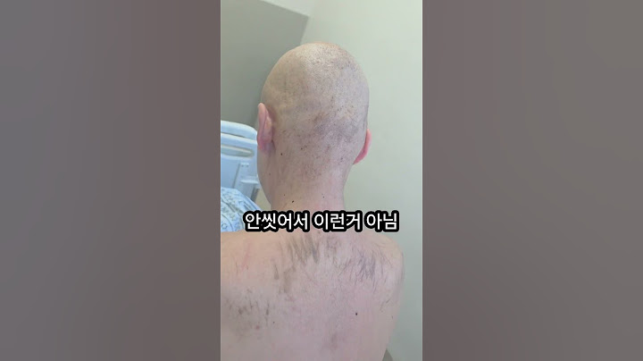 4차 항암 입원(feat.전격속살부작용공개!!) #vlog #유튜브하는암환자 #고환암 #브이로그 #암환자브이로그 #항암 #항암부작용#육종암
