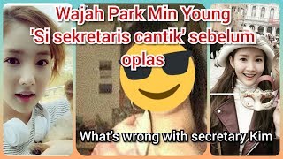 Wajah Park Min Young sebelum operasi plastik