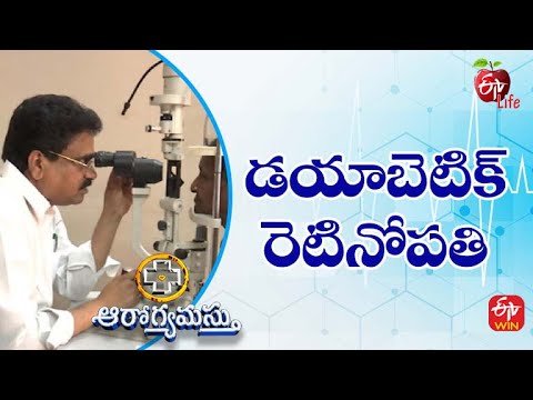 Diabetic Retinopathy | డయాబెటిక్ రెటినోపతి | Aarogyamastu | 28th  May 2022 | ETV Life