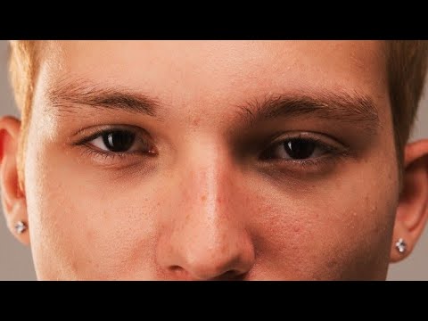 Thumbnail do vídeo