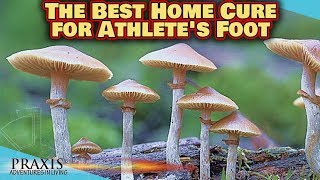 The Best Home Cure for Athletes Foot