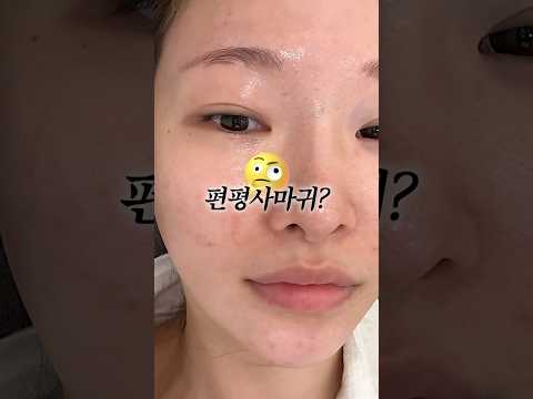 좁쌀인줄 알았는데 알고보니 <strong>편평사마귀</strong>..?