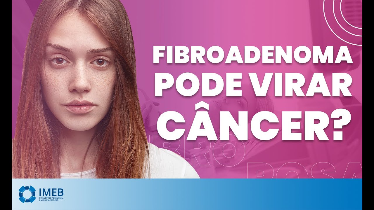 Quem Tem Fibroadenoma Tem Mais Chance De Ter Câncer De Mama?