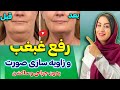 بهترین روش برای از بین بردن غبغب بدون نیاز به جراحی مزوتراپی لیپوماتیک و بهترین روش برای از بین بردن غبغب بدون نیاز به جراحی مزوتراپی لیپوماتیک و